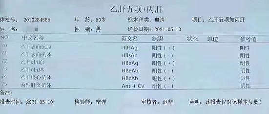 医案精粹：张雅丽医案----慢性乙型病毒性肝炎